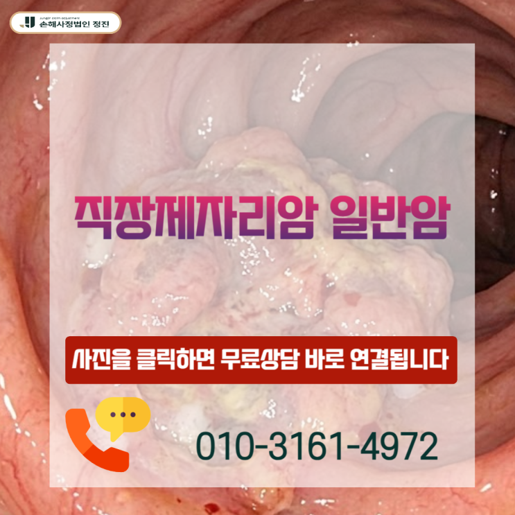  직장제자리암 일반암, D01 코드라 거절? 암진단비 100% 받은 실제 기준