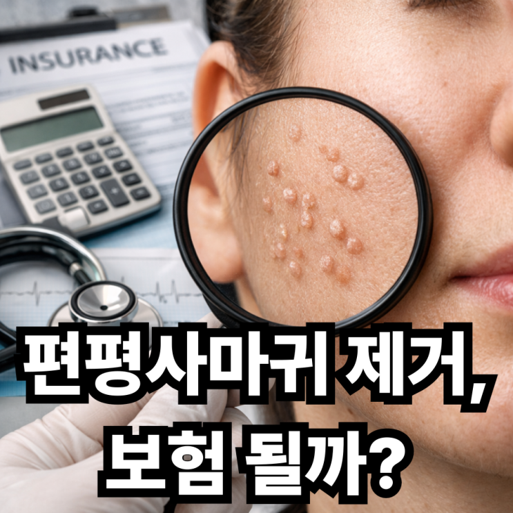  편평사마귀 보험 적용 가능 여부  실비·건강보험 어디까지 될까?