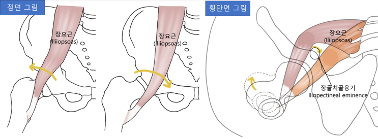  골반 주위에서 나는 소리 - 정체가 뭘까요?
