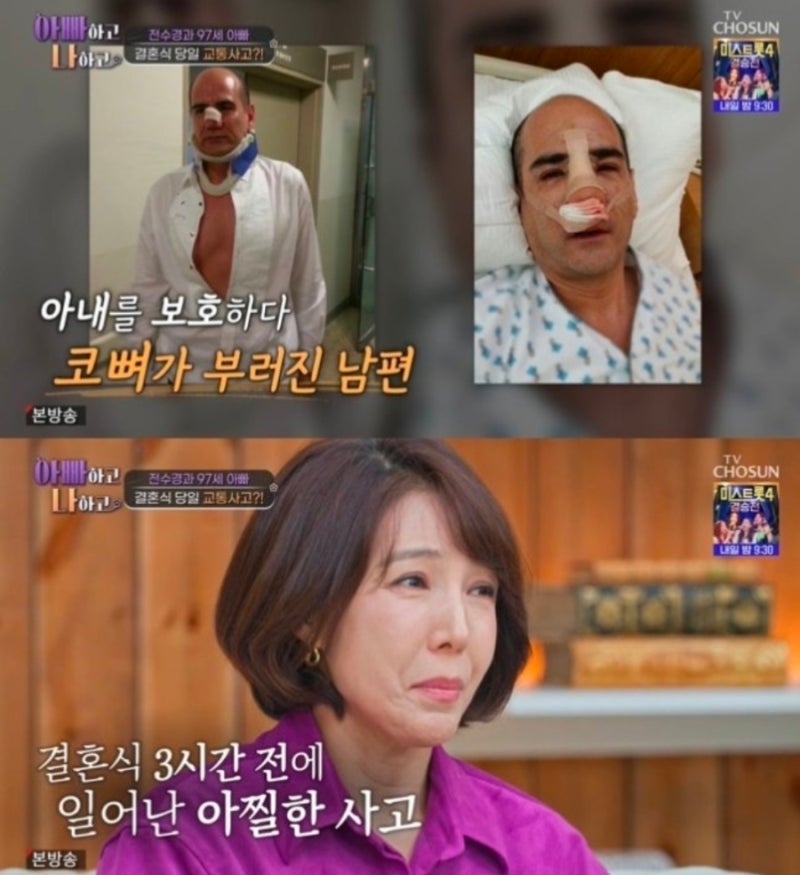 전수경 결혼식 3시간 전 사고…남편 코뼈 보일 정도 부상, 결국 결혼 강행한 이유