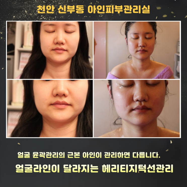  천안피부관리 얼굴관리를 받아도 턱선이 금방 돌아오는 이유｜신부동피부관리 아인 헤리티지 윤곽관리