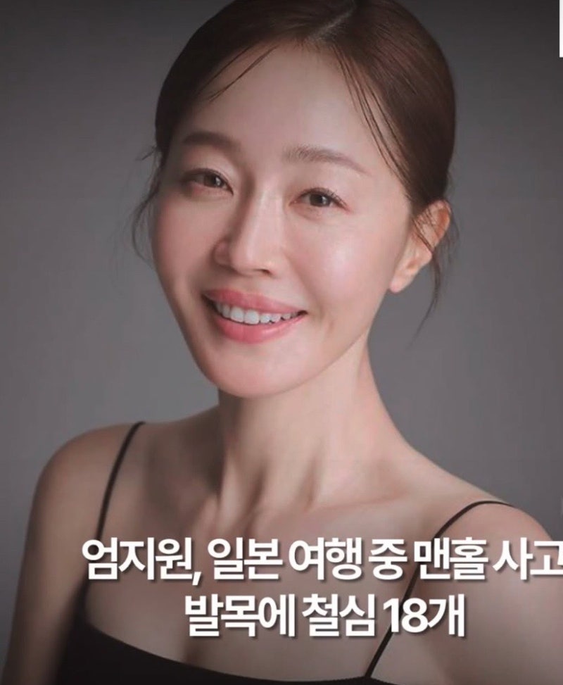 엄지원 발목 골절 사고, 남일 같지 않았던 이유 (골절 재활 경험담)
