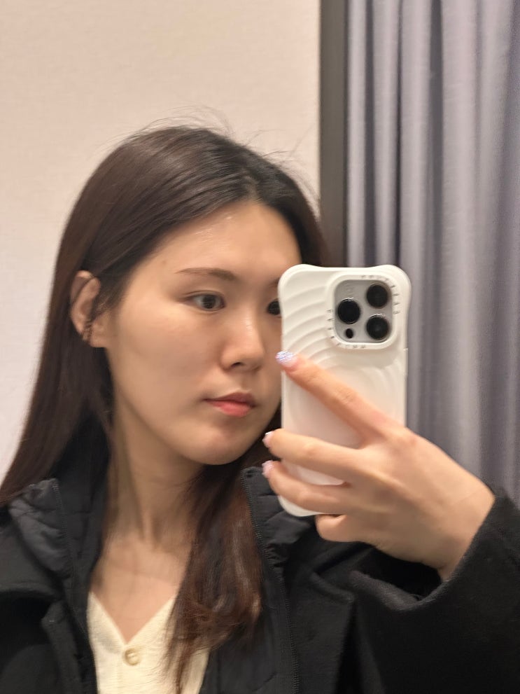  티타늄 vs 울쎄라 가격 레이저 리프팅 둘다 해본 비용 비교