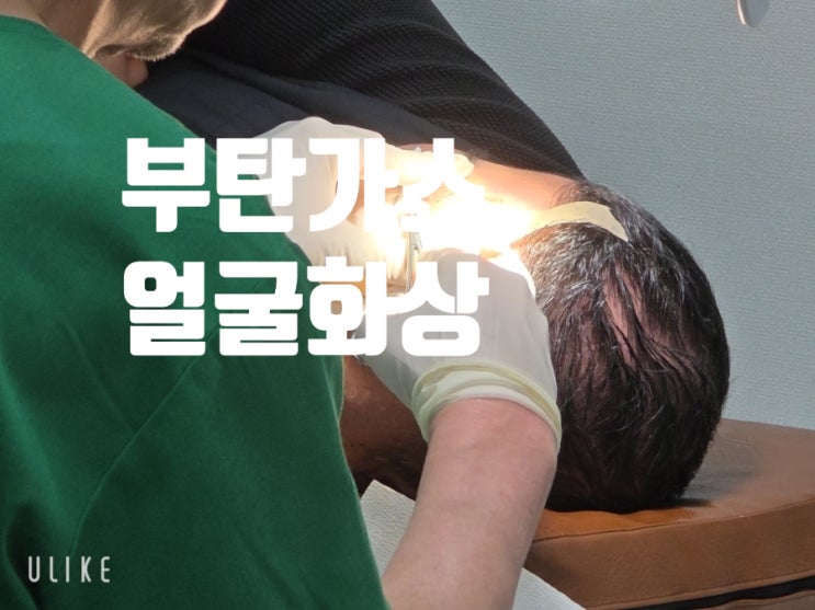  사직동분평동 부탄가스  얼굴 화상 환자가 생각보다 많습니다