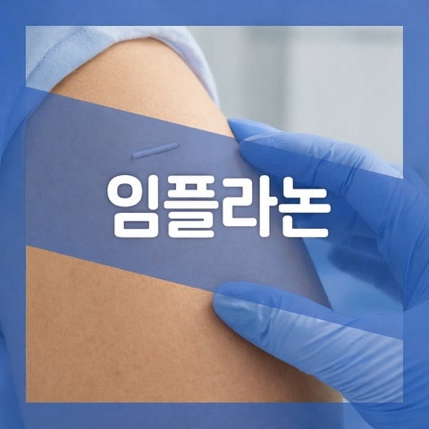 임플라논 뜻, 피임 시술 가격 효과 기간 부작용 제거방법