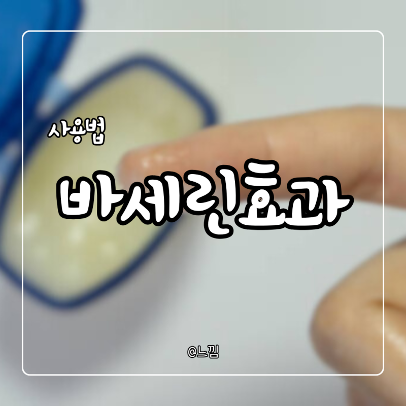 바세린 효과 손 화상 기미 상처
