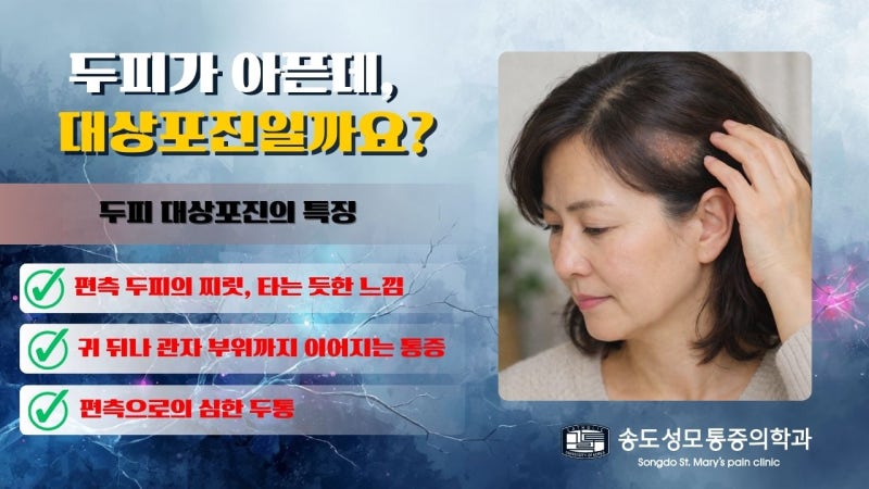 두피가 아픈데 대상포진일까요?
