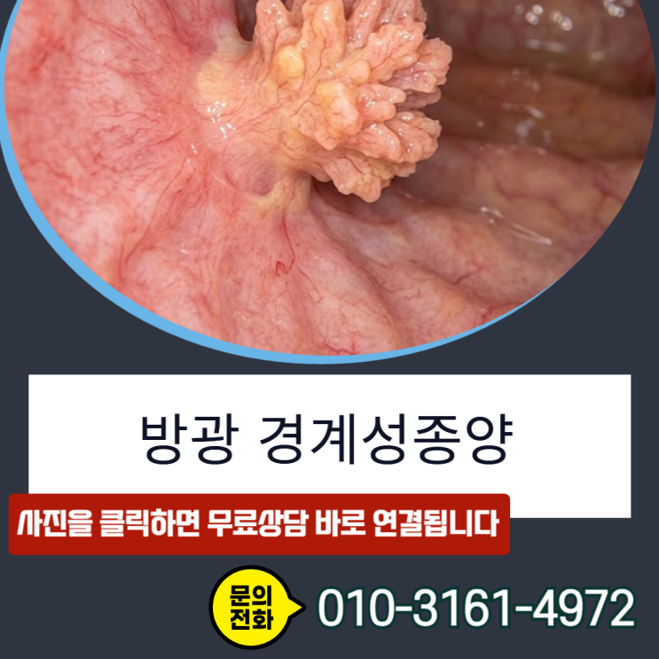  방광 경계성종양 , D41.4 코드라도 일반암 전액 받는 기준