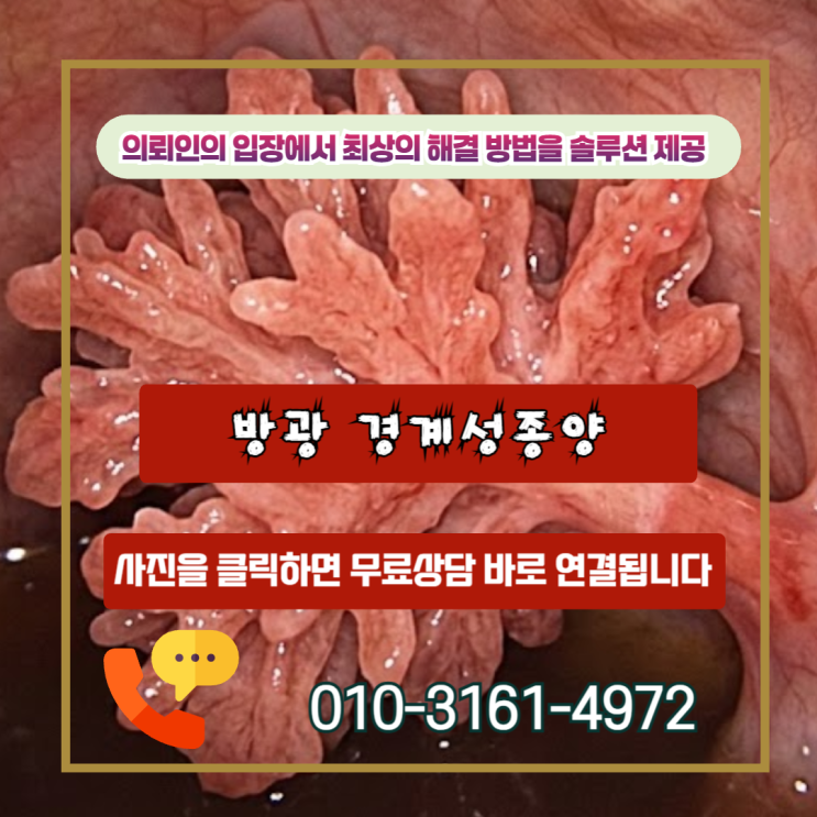  방광 경계성종양, 10%만 받았다면 꼭 보세요