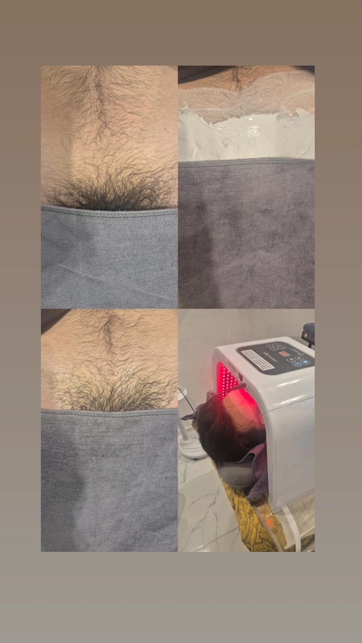  남자 브라질리언 왁싱. 겉으로 왁싱한 티는 안 나게, 좋은 점은 다 챙기고 싶다면? 영등포 남자 왁싱샵 “청춘케어”