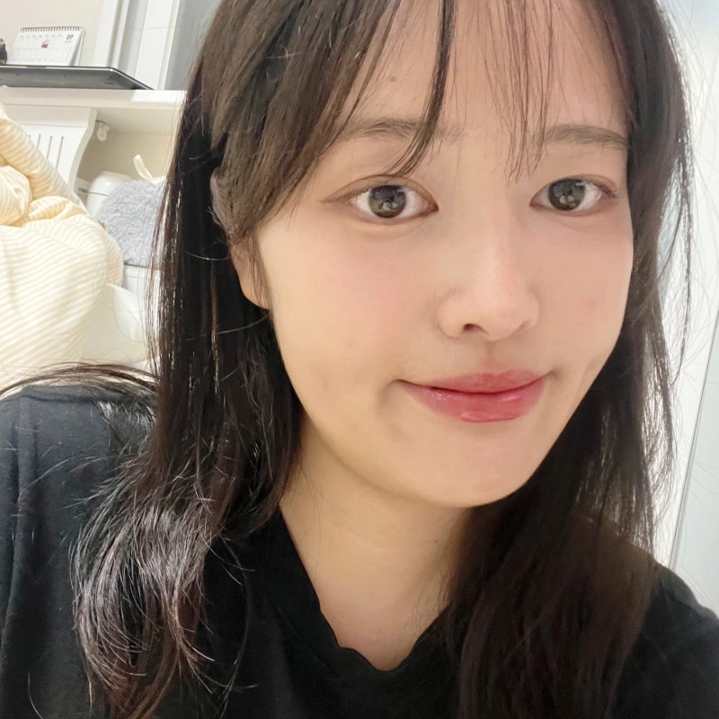 이갈이 수면용 마우스피스 가격, 고요 vs 치과 솔직 후기