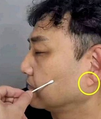   "귓불 주름 있으면 심장병?" 김수용 심근경색으로 퍼진 괴담, 서울대 교수가 밝힌 진실