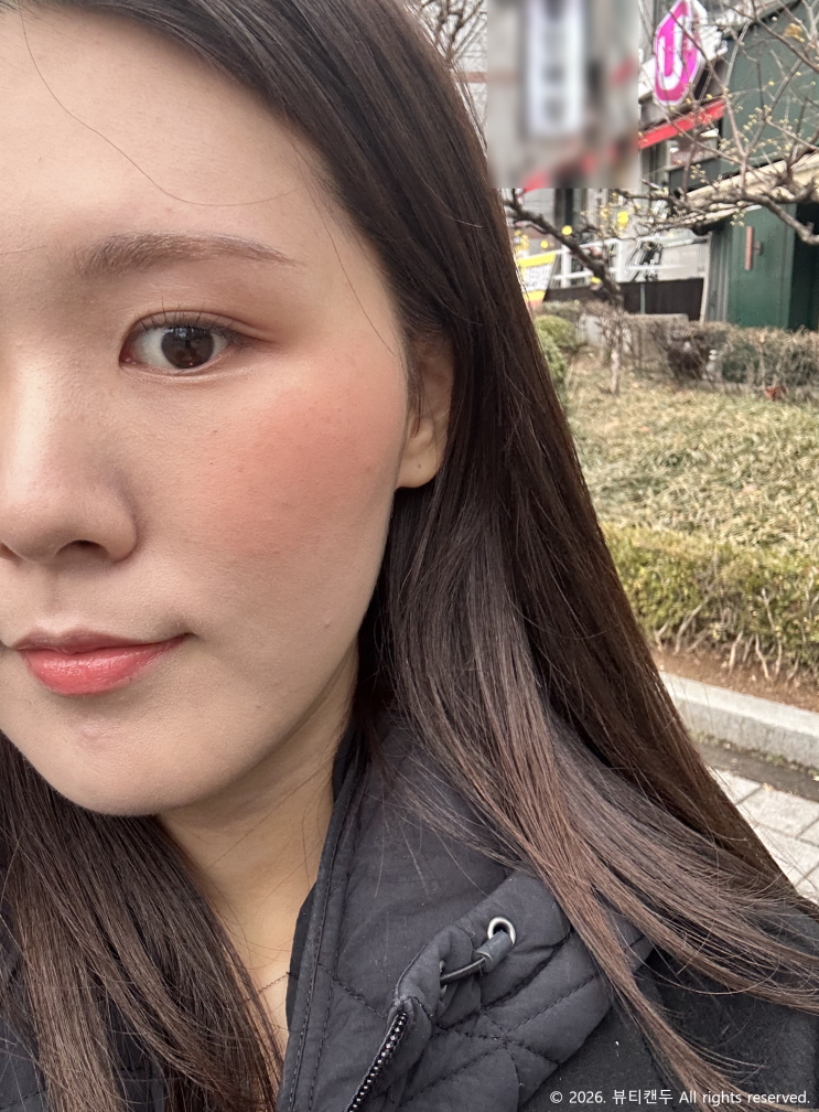  땅콩형 얼굴 리프팅 온다 레이저  도도티비 청담피부과 후기