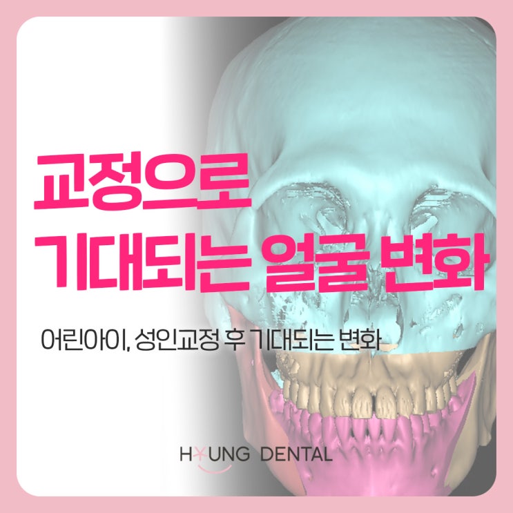  교정 후 턱변화, 영통 치과에서 알려드립니다