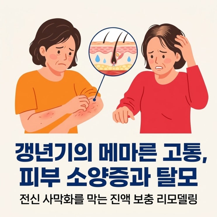  갱년기 피부 소양증 가려움 원인, 여성 탈모 증상과 두피 치료 (지르텍 미녹시딜 부작용)