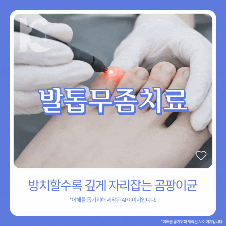  광주발톱무좀 병원 레이저 치료 원리와 부스러짐 변색 원인은 수완지구피부과에서