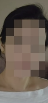   박나래 불법 시술 논란 주사이모의 당당한 얼굴 공개와 복귀 조짐?!