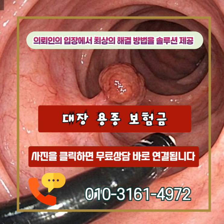  대장 용종 보험금, D12.6 코드인데도 제자리암 진단비 받는 이유