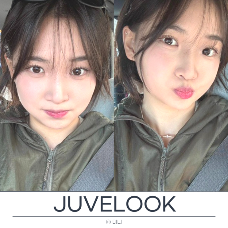  홍대피부과추천 쥬베룩볼륨 팔자 후기