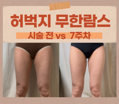  한성대역 허벅지 무한람스 7주 차 솔직 후기 : 승마살 실종, 이제는 안쪽 살 정복 중!