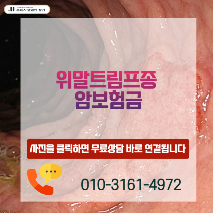  위말트림프종 암보험금, C88.4 코드인데 왜 소액암일까? 손해사정사가 밝히는 전액 수령 기준