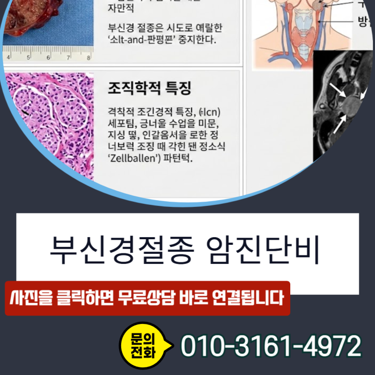  부신경절종 암진단비, 경계성 종양인데도 수천만 원 받는 이유
