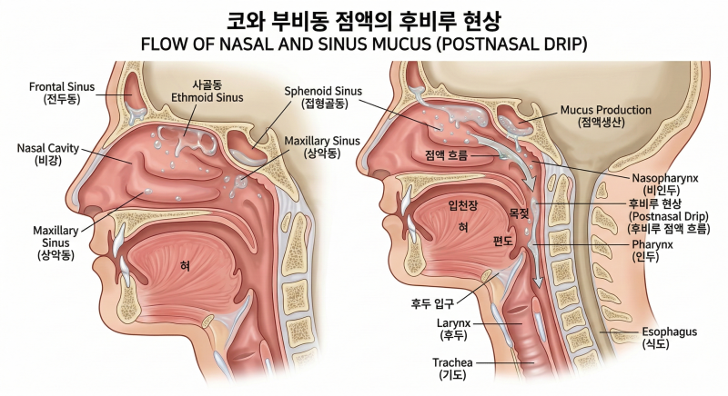 코가 목으로 넘어가는 불편함, [후비루]의 원인과 맞춤 치료