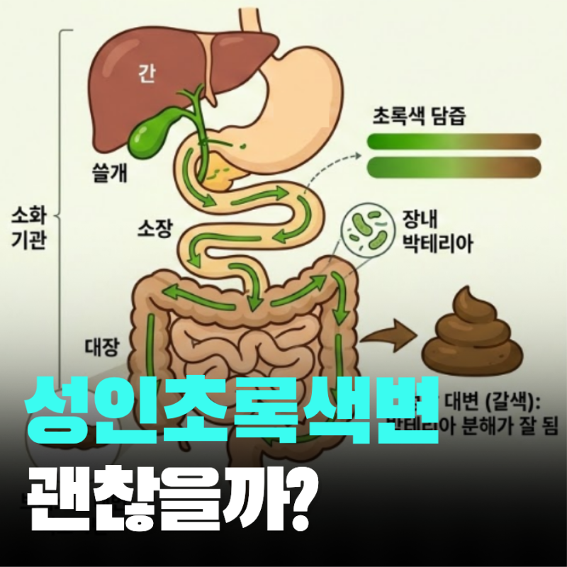 성인 초록색 변 원인과 질환 신호 구분법