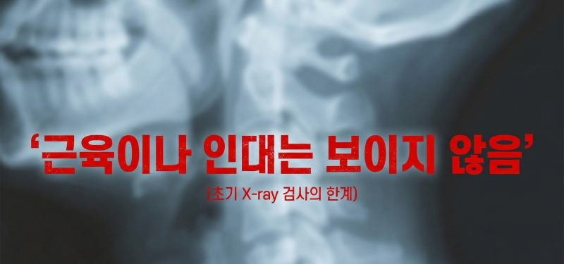 [이목한의원] 교통사고 후유증치료, 강서구 야간진료