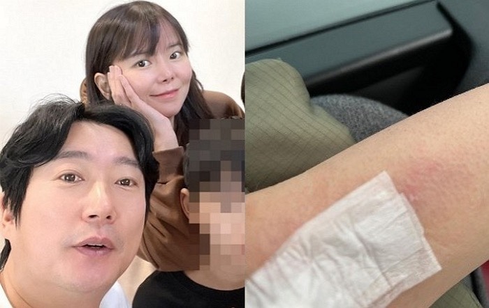   아버지 이어 친오빠까지… 이수근 아내 박지연, 14년 만의 신장 재이식 눈물 나는 가족사