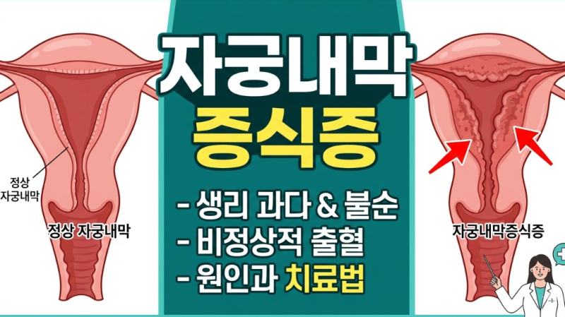 생리 양이 갑자기 많아졌다면? 자궁내막증식증 원인부터 치료까지