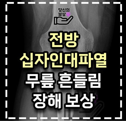 산재 전방십자인대파열 장애등급 12급 승인 비결은?(실제사례 포함)