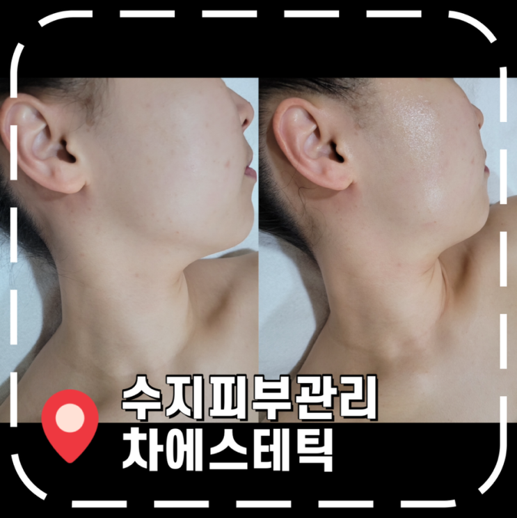  [수지피부관리] 경력 25년 된 용인경락, 웨딩 본식 한 달 관리 추천- '차에스테틱'