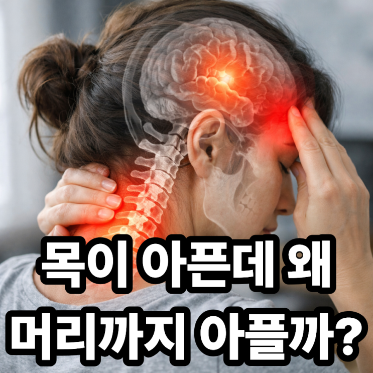  목디스크와 두통의 관계, 왜 머리까지 아플까? 목에서 시작되는 두통의 진짜 원인