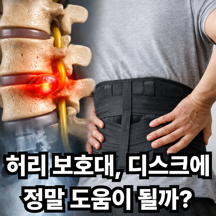  허리 디스크와 허리 보호대 사용 효과, 정말 도움이 될까?