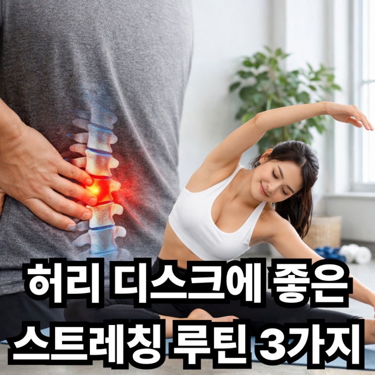  허리 디스크 환자를 위한 허리 스트레칭 루틴 만들기, 안전하게 하는 방법