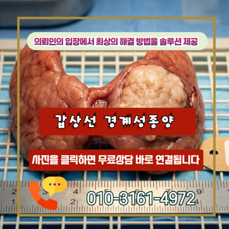  갑상선 경계성종양 D44 진단, 소액암 10%만 받으셨나요? 일반암100% 받는 기준