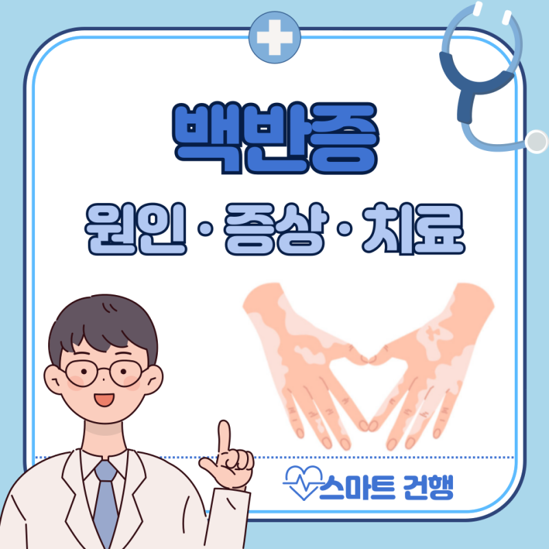 백반증 원인, 초기 증상, 치료 방법, 비용 : 피부, 얼굴, 혀, 아기
