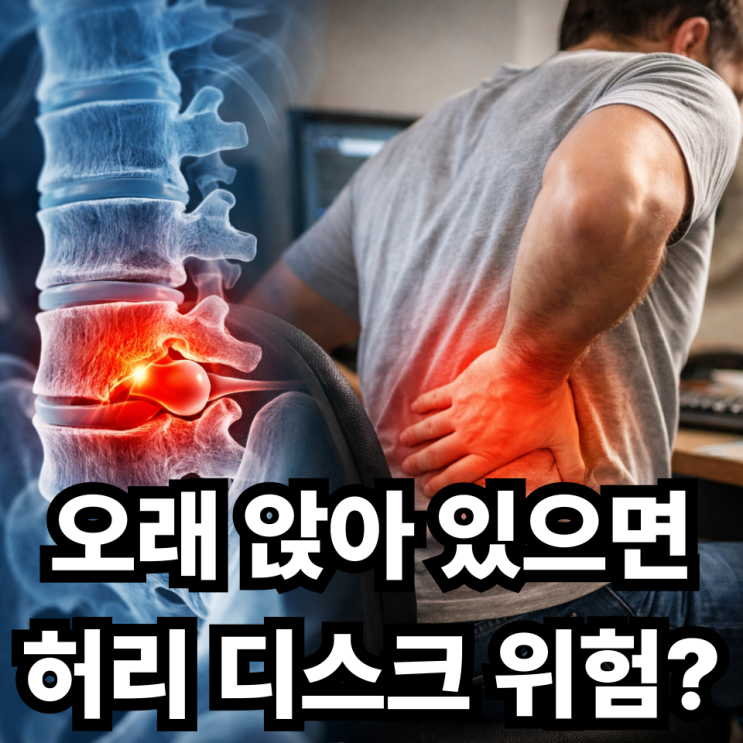  허리 디스크와 장시간 앉아 있는 습관의 위험성, 허리가 망가지는 생활 습관