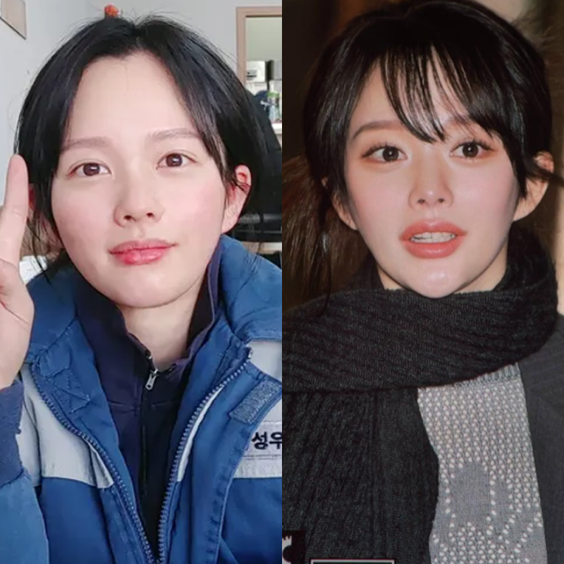정지소 최근 근황에 성형 논란 터진 이유