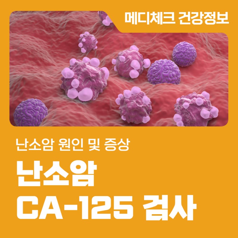 한국건강관리협회 대전충남지부 난소암 원인 및 증상
