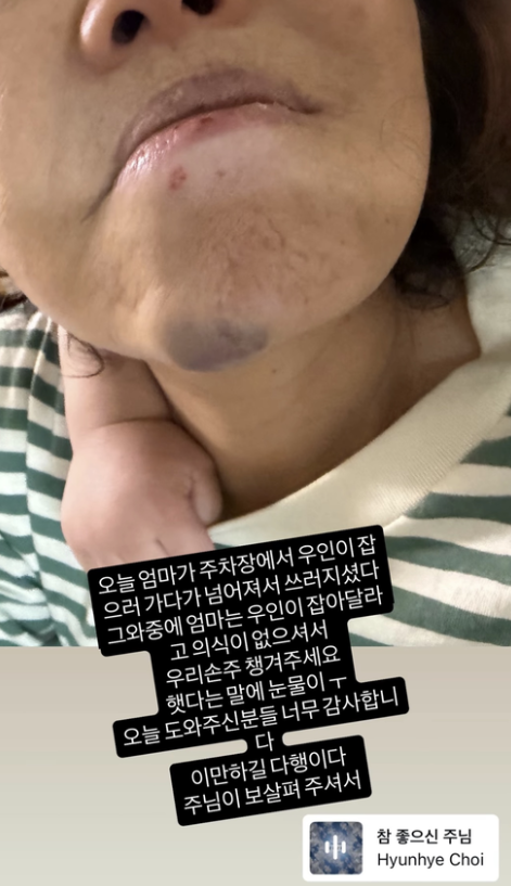   김용건 며느리 배우 황보라 가슴 철렁한 소식 어머니 사고 후 전해진 감동