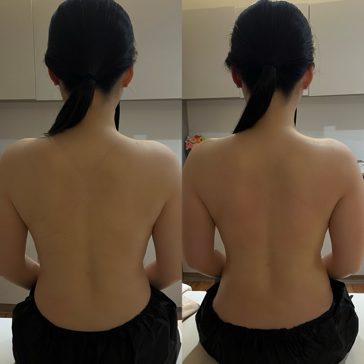  부산 동래 피부관리 : 보에스테틱 등신경테라피