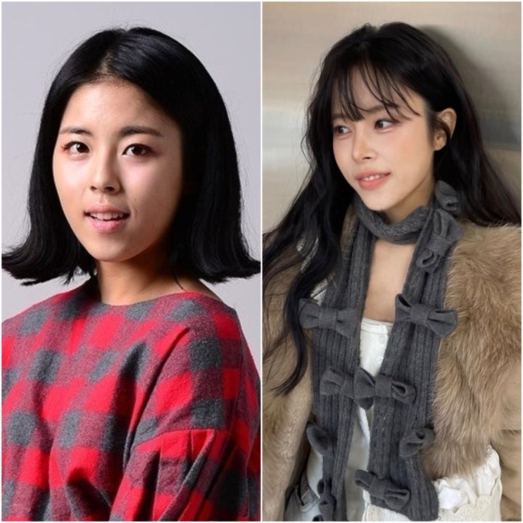  '이렇게 변한다고..? 응팔 윤진이 달라진 얼굴에 화들짝