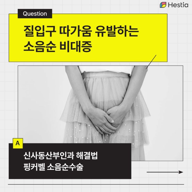 질입구 따가움 유발하는 소음순 비대증, <b>신사동산부인과</b> 해결법