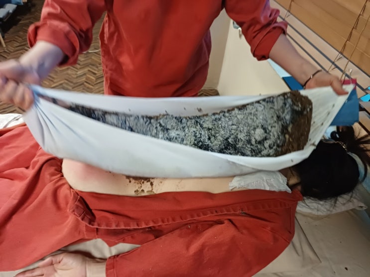  복막전이와 말기암, 항암 치료가 유일한 길일까? 새로운 시각으로