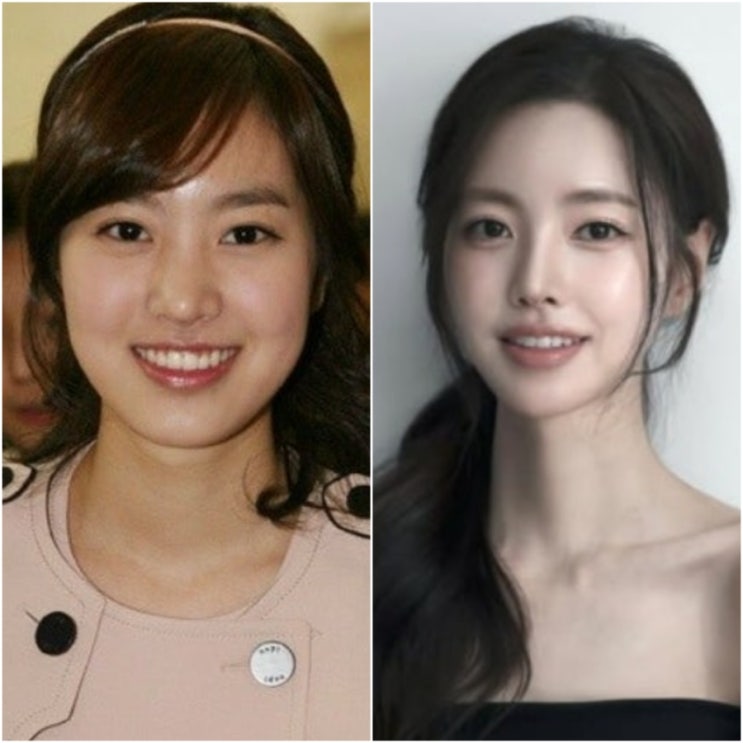  '너무 변해서 못 알아봄..' 진세연 과거 얼굴 변천사