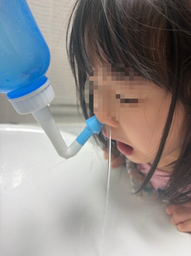 환절기 비염 & 코감기 졸업! 아이도 스스로 하는 '나잘후레쉬' + '코코야' 코세척 꿀조합 강추 ....