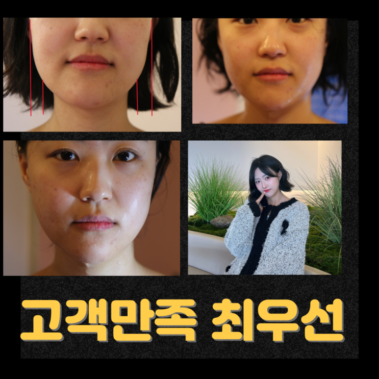  천안 신부동 피부관리실에서 새로운 관리공간을 준비하는 이유｜다이어트 부종관리 순환관리 기기 검토