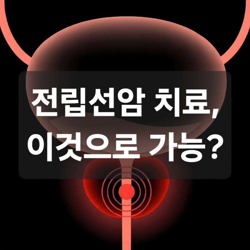전립선암 방사선치료 종류, 기간, 비용, 부작용 총정리